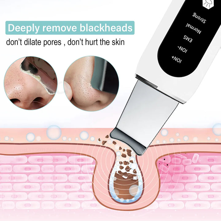 PurePulse Blackhead Eraser